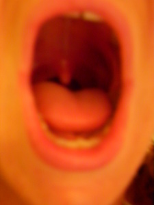 My tonsils & Uvula up close - WMV HD