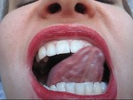 My Mouth And Tonsils